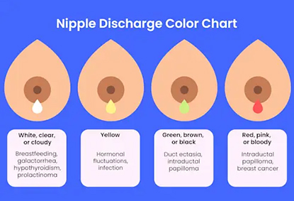 White, Green, Or Watery Nipple Discharge: What You Need To Know